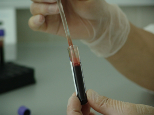 Centro Universitário prorroga prazo para realização de testes gratuitos de DNA