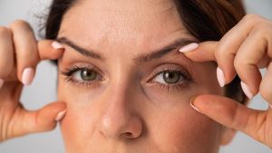 Blefaroplastia: A Cirurgia Para Pálpebras Cansadas ou Caídas