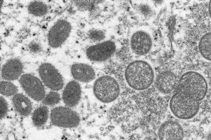Sobe para 03 o número de casos suspeitos de varíola do macaco em Vitória da Conquista