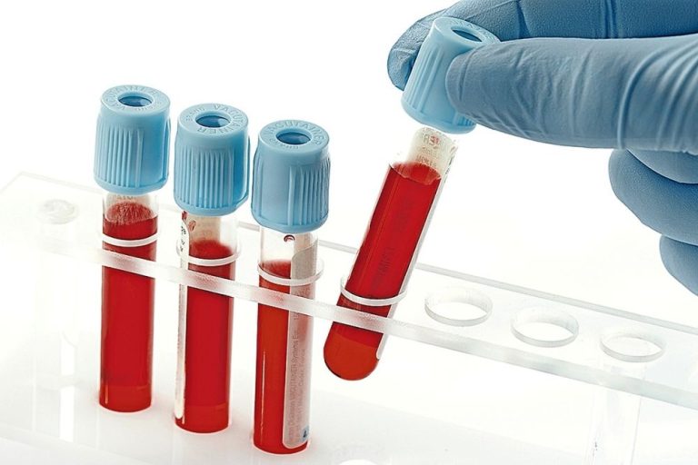 Vereadora quer coleta de exames laboratoriais nos postos de saúde de Vitória da Conquista.