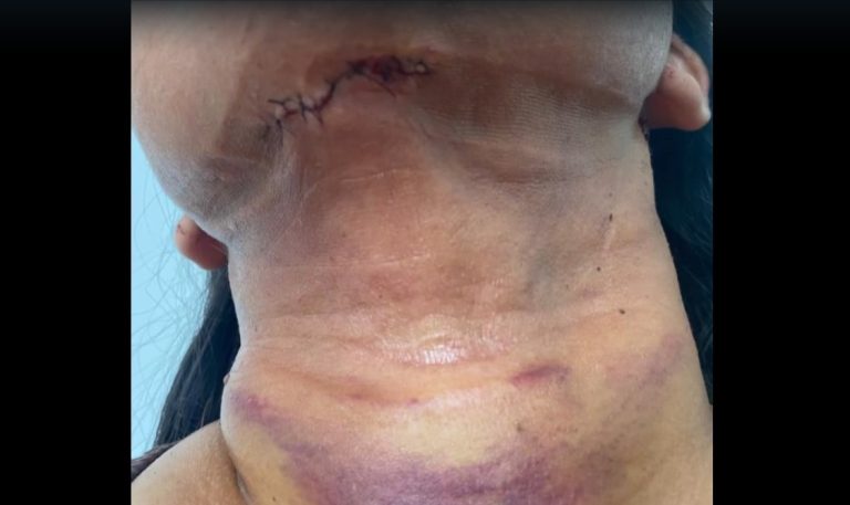 Dentista é indiciada por causar deformidades em pacientes e por exercício ilegal da medicina em Vitória da Conquista