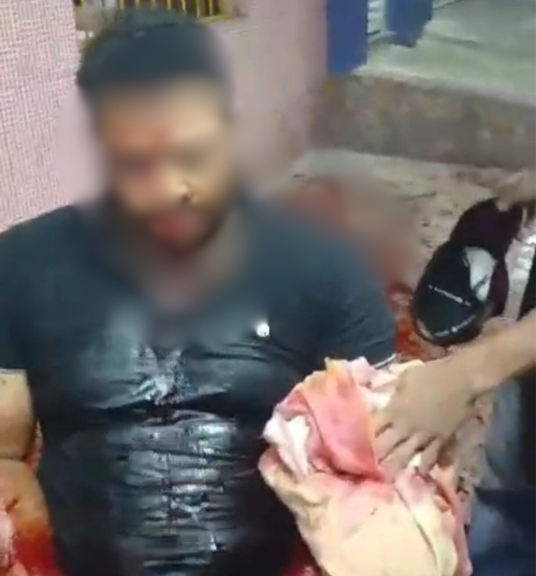 Homem é brutalmente esfaqueado no Jurema em Conquista