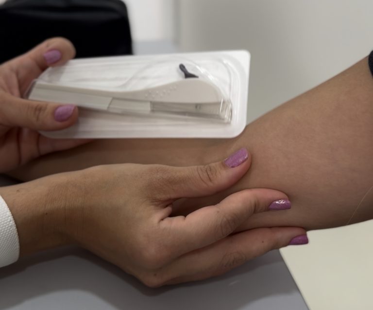 Vitória da Conquista dá início à oferta de novo método contraceptivo para adolescentes com vida sexual ativa