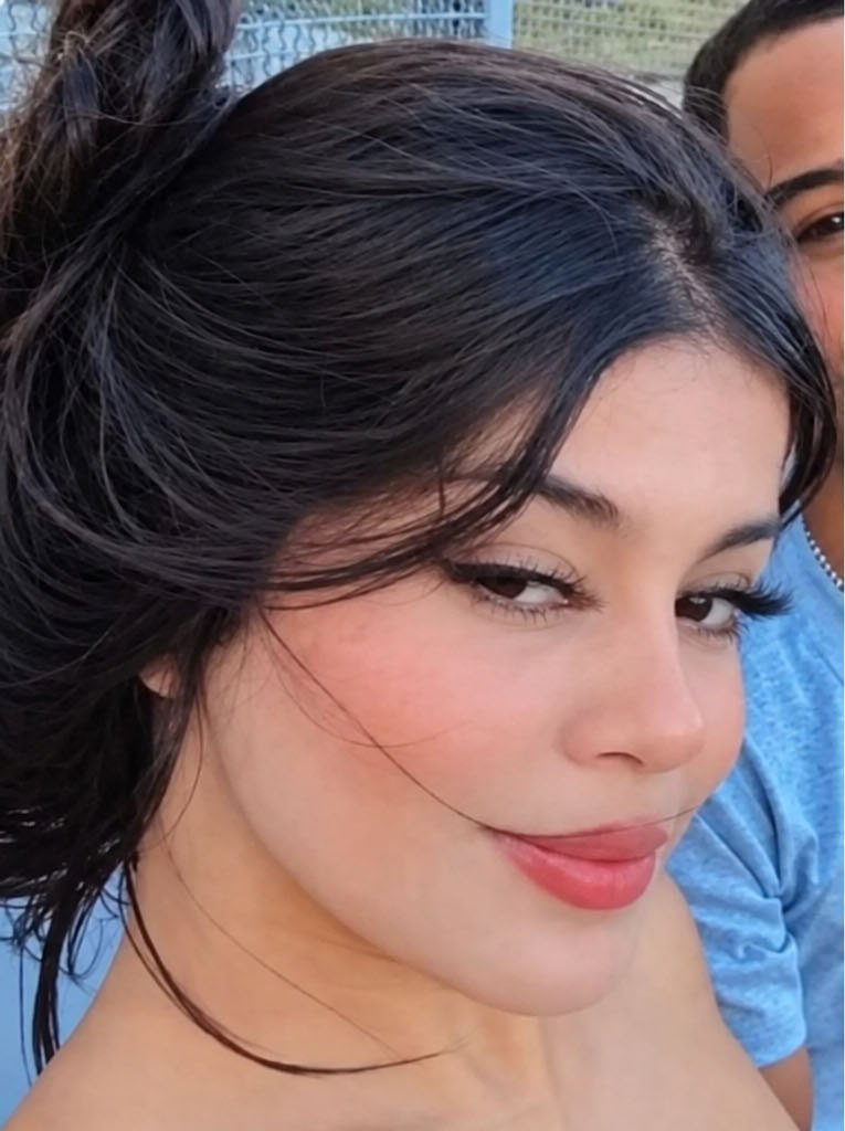 Paloma da Silva Gomes, de 21 anos, sofreu queimaduras e foi hospitalizada em Vitória da Conquista